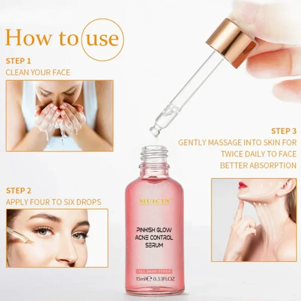 V9 PINKISH GLOW ANTI ACNE FACE SERUM - BLEMISH-FREE RADIANCE