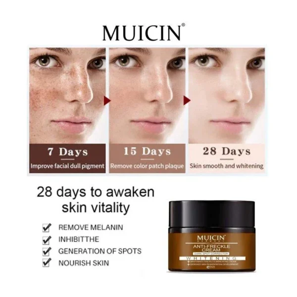 Anti-Freckle Deal